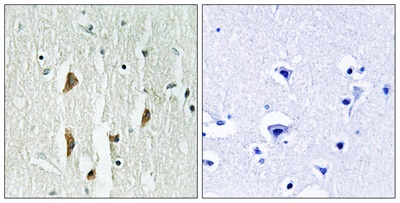 PAK1/2/3 Polyclonal Antibody