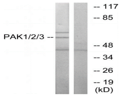 PAK1/2/3 Polyclonal Antibody