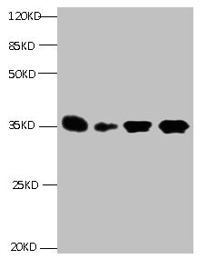 IGFBP1 Monoclonal Antibody