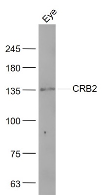 CRB2 Polyclonal Antibody