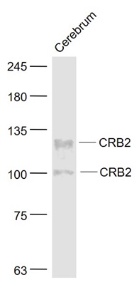 CRB2 Polyclonal Antibody