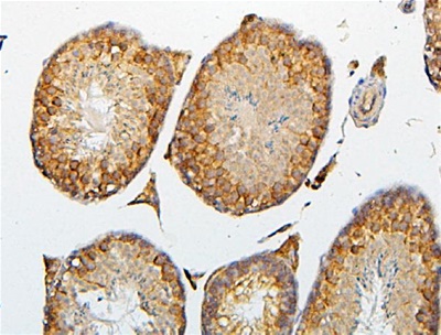 CRB1 Polyclonal Antibody