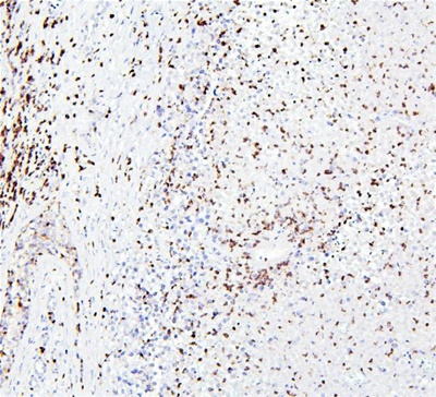 CRB1 Polyclonal Antibody