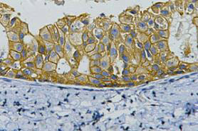 HER2 Monoclonal Antibody(11H9)