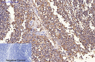 HER2 Monoclonal Antibody(11H9)