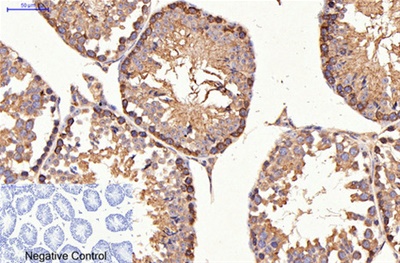 HER2 Monoclonal Antibody(11H9)