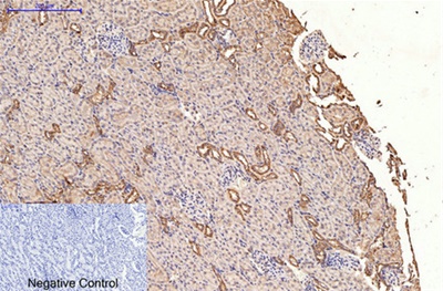 HER2 Monoclonal Antibody(11H9)