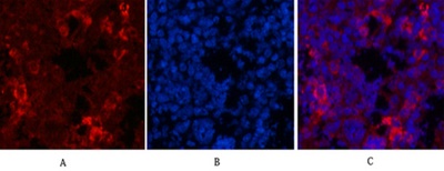 HER2 Monoclonal Antibody(11H9)