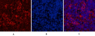 HER2 Monoclonal Antibody(11H9)