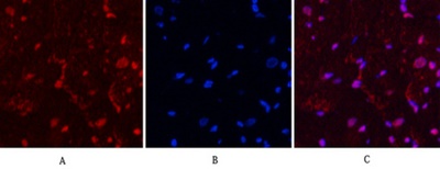 PR Monoclonal Antibody(Z15)