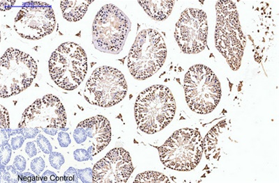 PR Monoclonal Antibody(Z15)