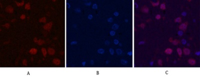 Ki 67 Monoclonal Antibody(4A8)