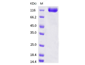 SARS-CoV Spike S1+S2 ECD-His Recombinant Protein (S577A, Isolate Tor2)