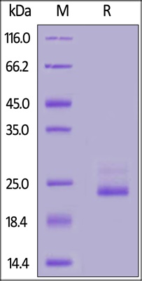 Recombinant Human Interleukin 6(IL6) Protein