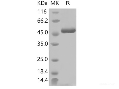 Recombinant SARS-COV-2 Nucleocapsid Protein (His Tag)