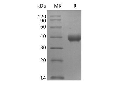Recombinant SARS-COV-2 Spike Protein (RBD-SD1, His Tag)
