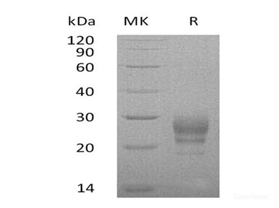 Recombinant Human Interleukin 7(IL-7) Protein