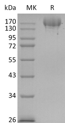 SARS-CoV-2 (2019-nCoV) S-trimer Protein (Mammalian, C-6His)