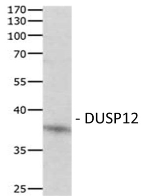 DUSP12 Polyclonal Antibody