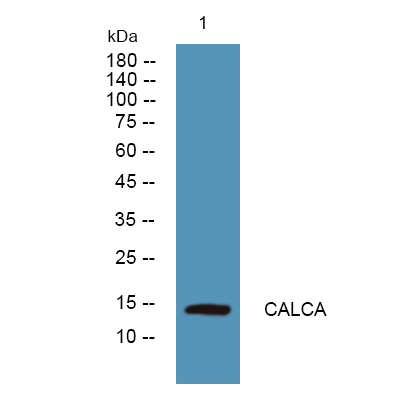 CALCA Rabbit pAb