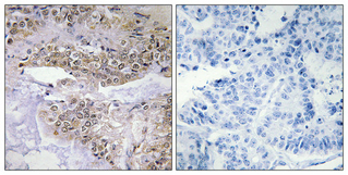 Cofilin (Phospho Ser3) Rabbit pAb