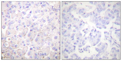 E-cadherin Polyclonal Antibody