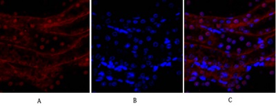 E-cadherin Polyclonal Antibody