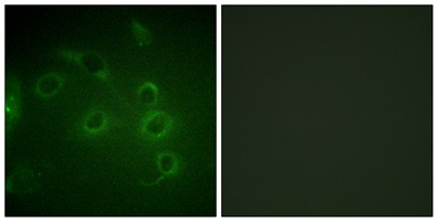 CD45 Polyclonal Antibody