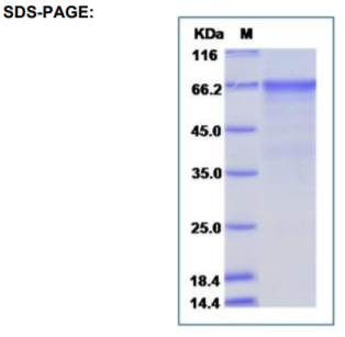 Enterovirus D68 (EV-D68) (strain Fermon) VP1 Protein (Fc Tag) VP1 Protein (Fc Tag)