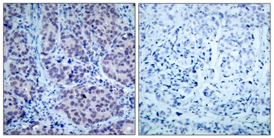 HDAC2 Polyclonal Antibody