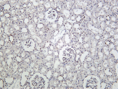STAT3 (Phospho Ser727) (PT0911R) PT® Rabbit mAb
