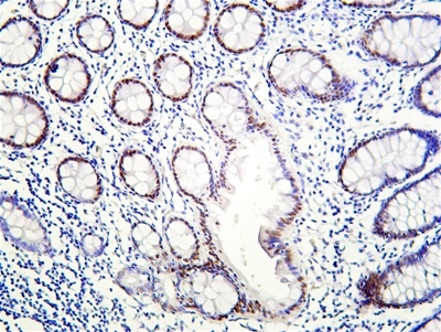 KLF4 (PT0167R) PT® Rabbit mAb