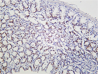 KLF4 (PT0167R) PT® Rabbit mAb