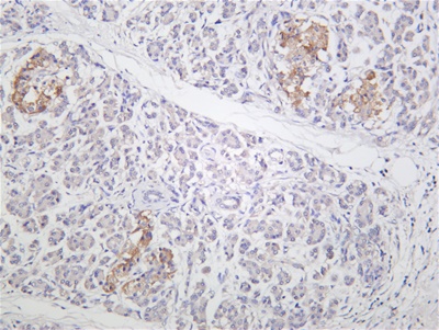STAT3 (PT0496R) PT® Rabbit mAb