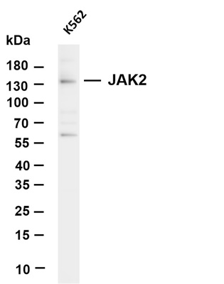 JAK2 (PT0503R) PT® Rabbit mAb