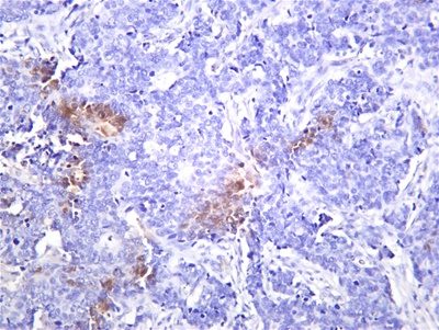 JAK2 (PT0503R) PT® Rabbit mAb