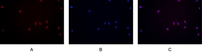 JAK2 (PT0503R) PT® Rabbit mAb