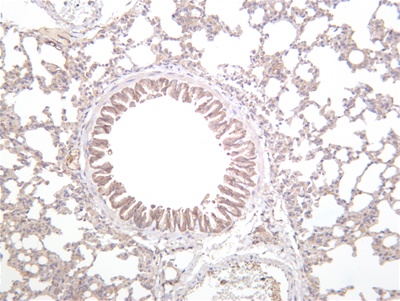 JAK2 (PT0503R) PT® Rabbit mAb