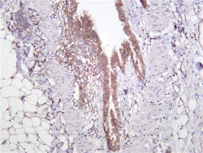 JAK2 (PT0503R) PT® Rabbit mAb