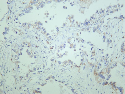 JAK1 (PT0658R) PT® Rabbit mAb