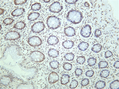 STAT3 (Phospho Tyr705) (PT0742R) PT® Rabbit mAb