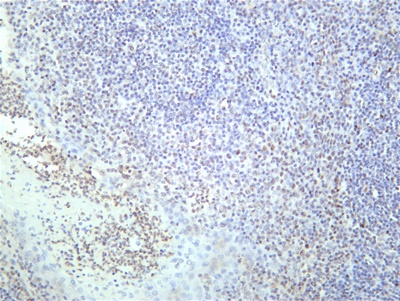 STAT3 (Phospho Tyr705) (PT0742R) PT® Rabbit mAb