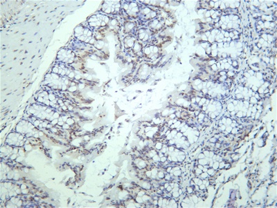 STAT3 (Phospho Tyr705) (PT0742R) PT® Rabbit mAb