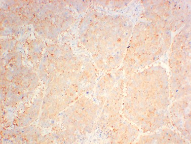 JAK2 (2C2) Mouse mAb