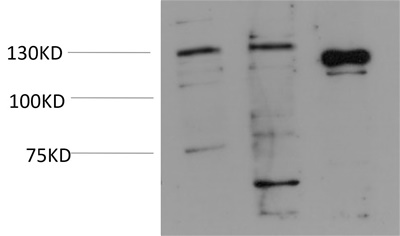 JAK2 (2C2) Mouse mAb
