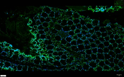 KLF4 (PT0167R) PT® Rabbit mAb
