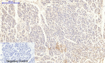 JAK2 (Phospho Tyr1007) Rabbit pAb