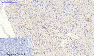 JAK2 (Phospho Tyr1007) Rabbit pAb