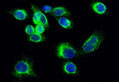 JAK3 (PT0405R) PT® Rabbit mAb