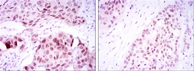 SOX-2 Mouse mAb